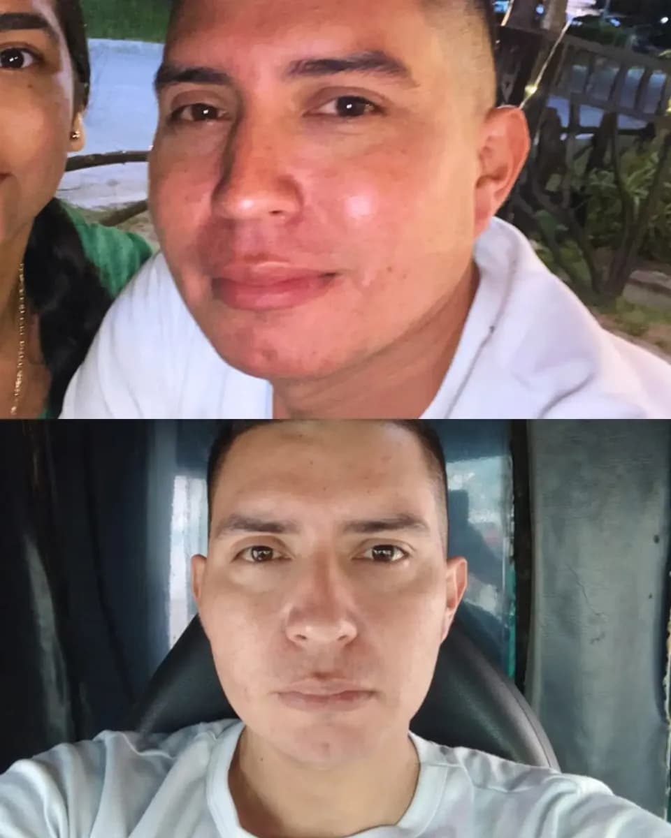 Comparación del antes y después de Yair con cambios visibles en la apariencia de su piel